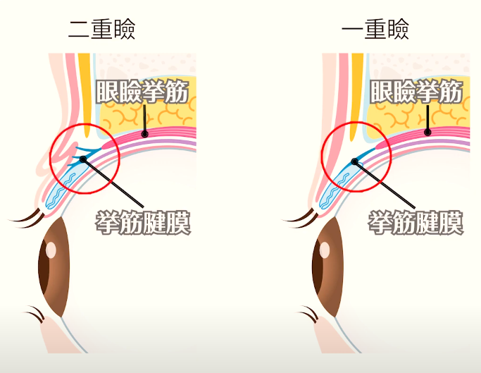 一重と二重の違い