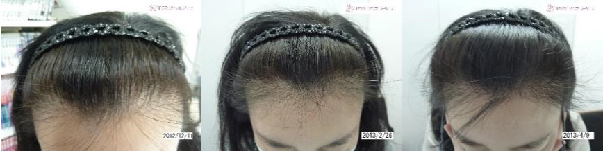 ドクターズヘアレディース症例写真